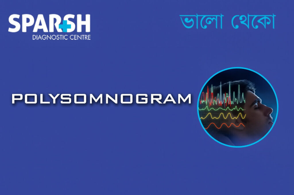 Polysomnogram: Understanding the Gold Standard Sleep Study Test ...