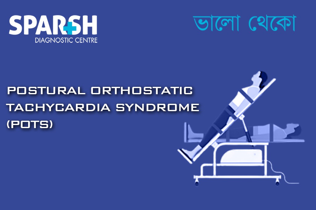 Postural Orthostatic Tachycardia Syndrome POTS CP