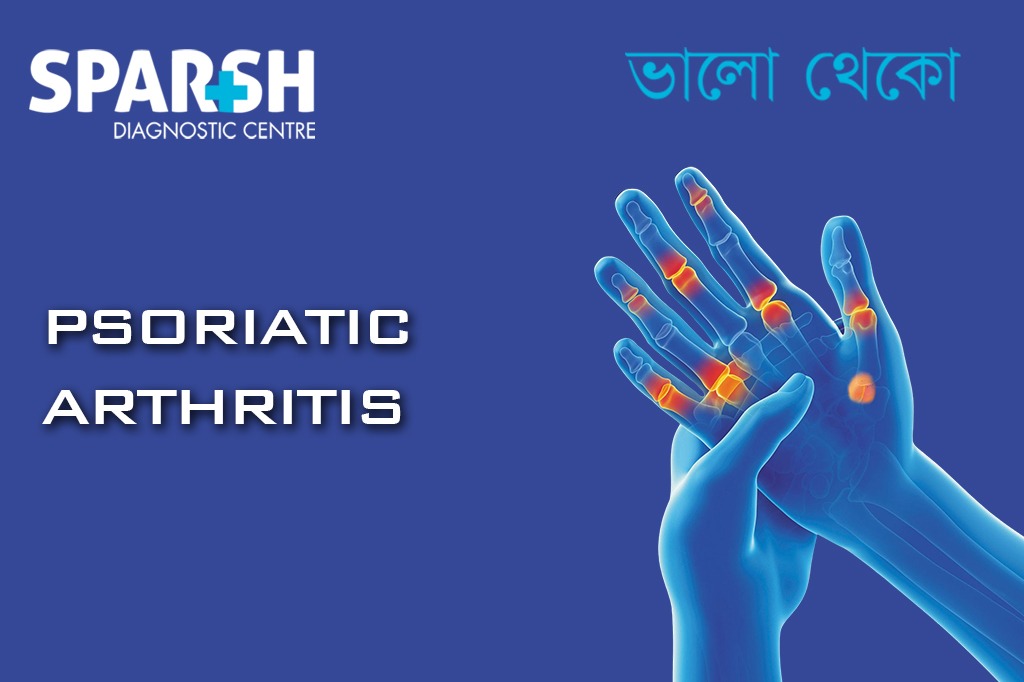 Psoriatic Arthritis CP
