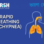 Rapid Breathing Tachypnea