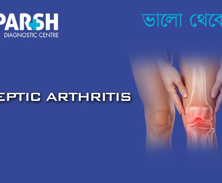 Septic Arthritis CP