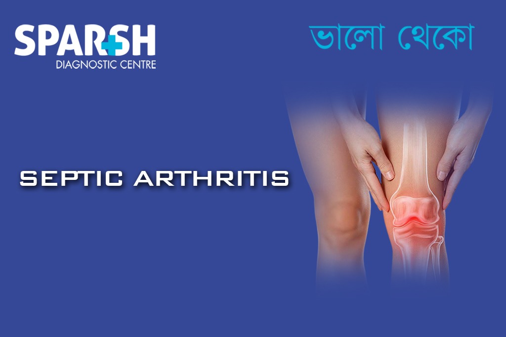 Septic Arthritis CP