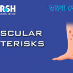 Vascular Asterisks