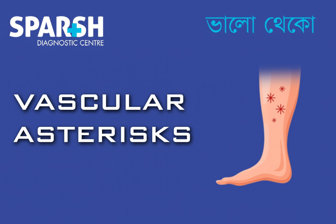 Vascular Asterisks