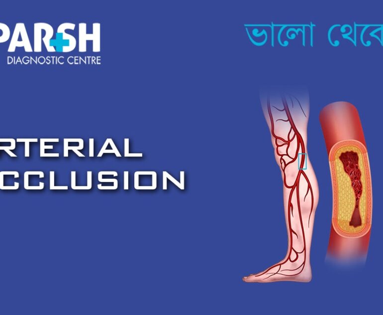 Arterial Occlusion CP