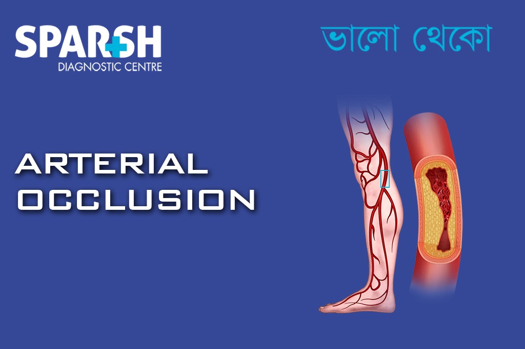 Arterial Occlusion CP