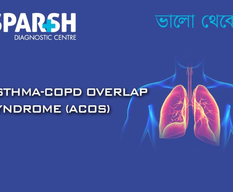 Asthma COPD Overlap Syndrome ACOS