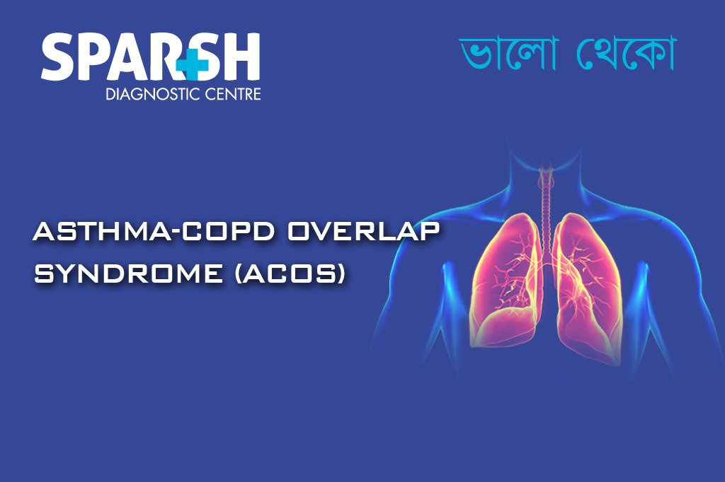 Asthma COPD Overlap Syndrome ACOS
