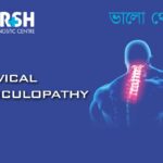 Cervical Radiculopathy CP
