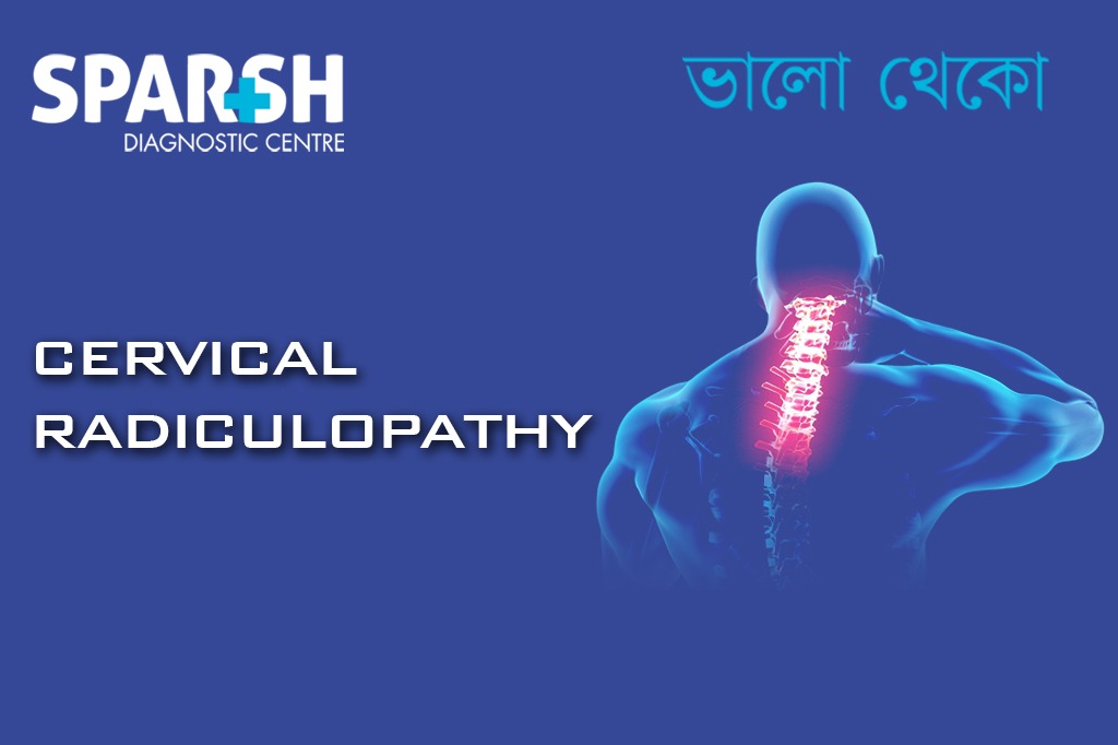 Cervical Radiculopathy CP