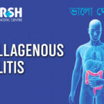 Collagenous Colitis