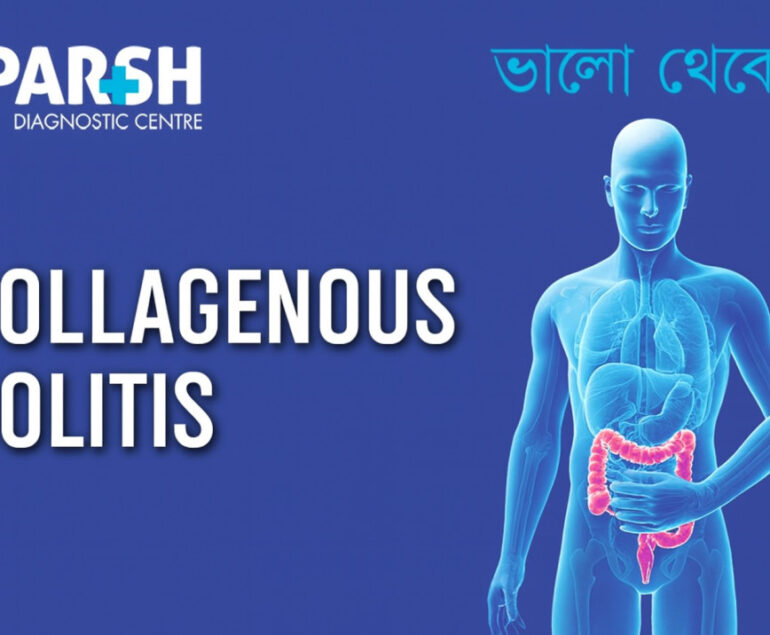 Collagenous Colitis