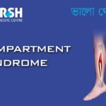 Compartment Syndrome CP