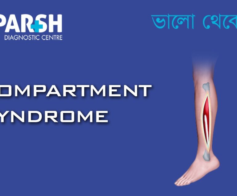 Compartment Syndrome CP
