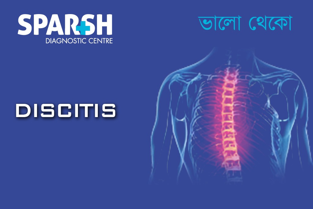 Discitis