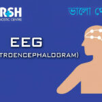 EEG Electroencephalogram