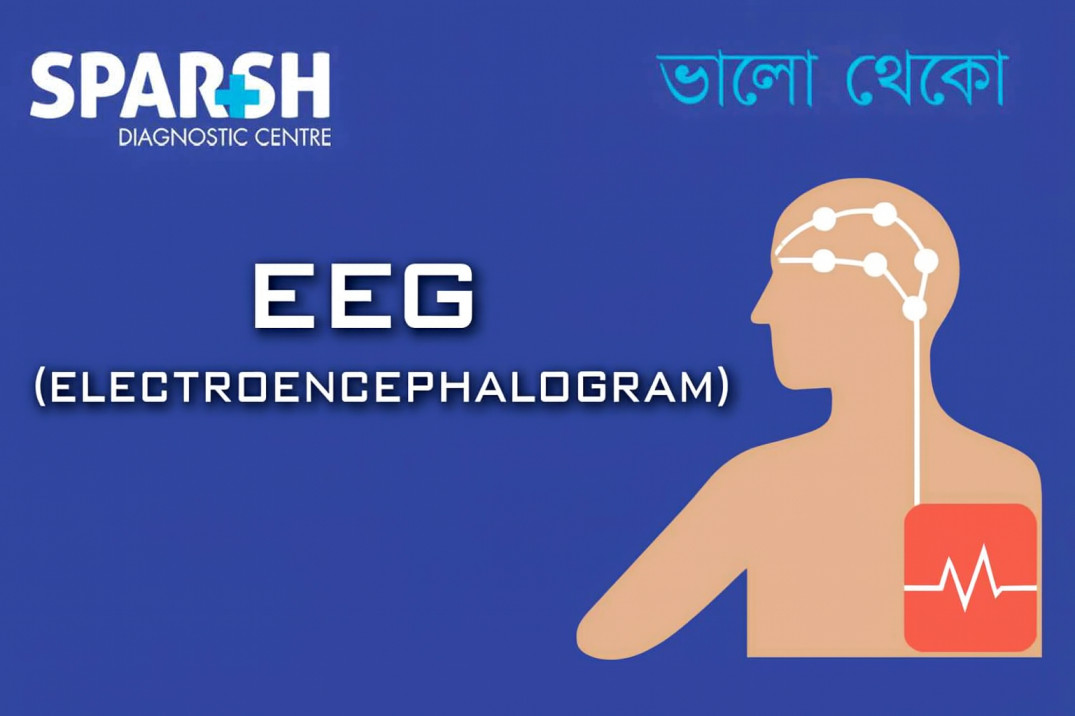 EEG Electroencephalogram
