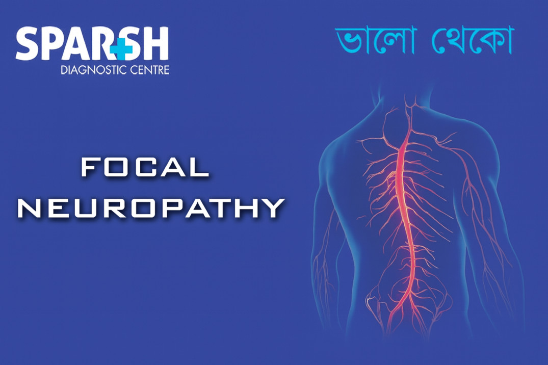 Focal Neuropathy