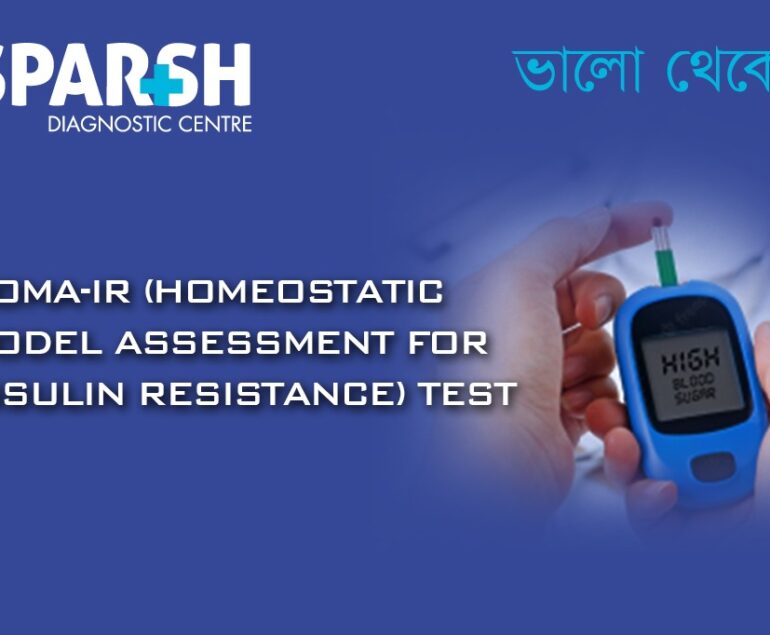HOMA IR