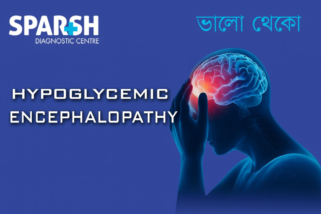 Hypoglycemic Encephalopathy