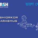 Kwashiorkor And Marasmus