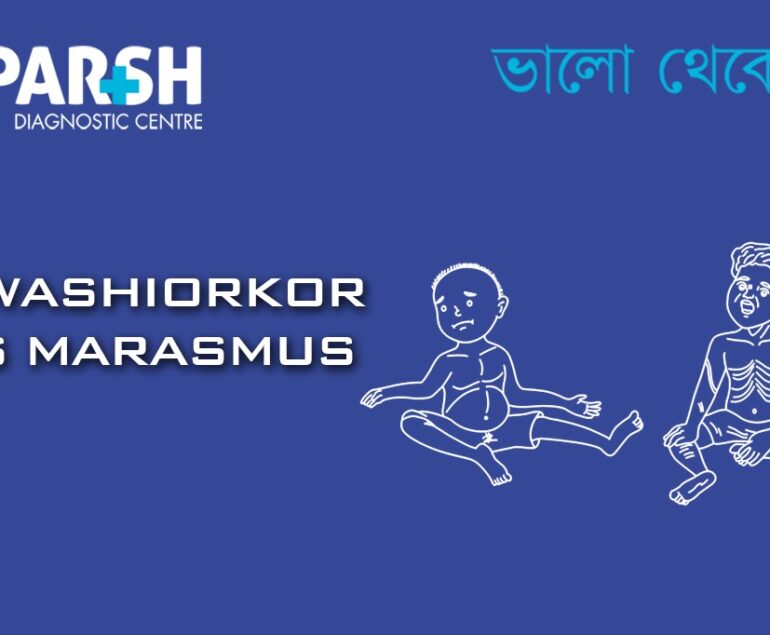 Kwashiorkor And Marasmus