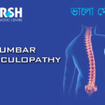 Lumbar Radiculopathy