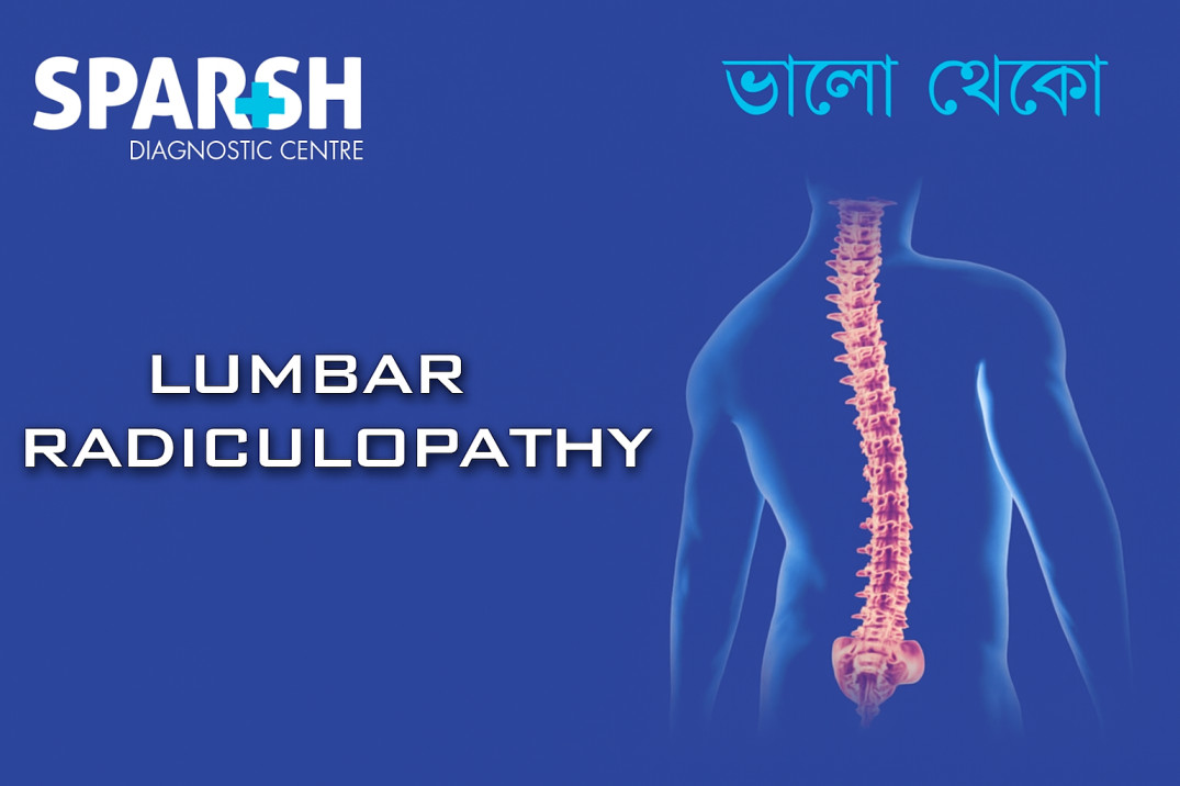 Lumbar Radiculopathy