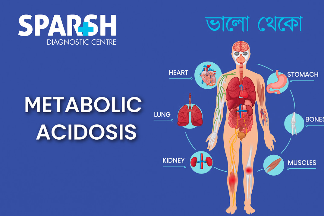 Metabolic Acidosis