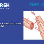 Nerve Conduction Studies, NCV