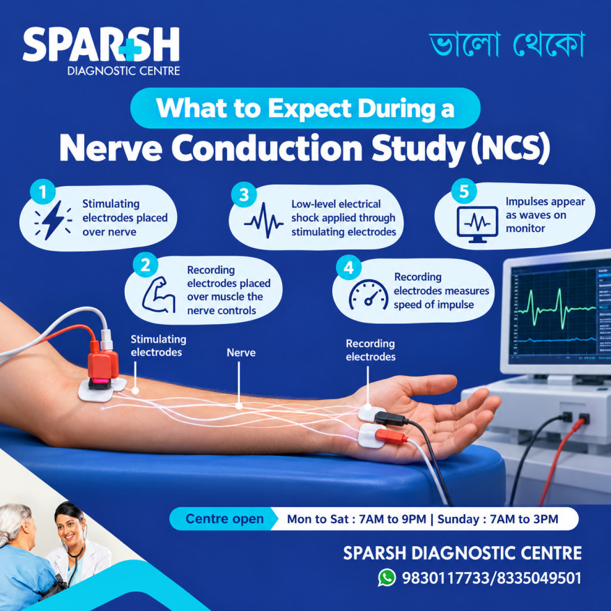 Nerve Conduction Study NCS