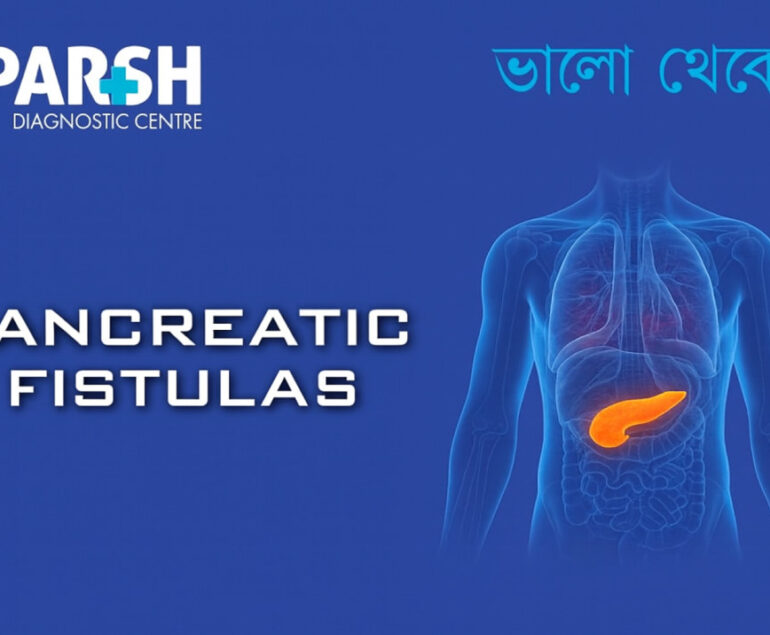 Pancreatic Fistulas