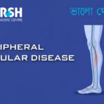Peripheral Vascular Disease