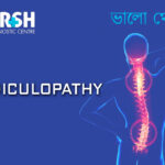 Radiculopathy