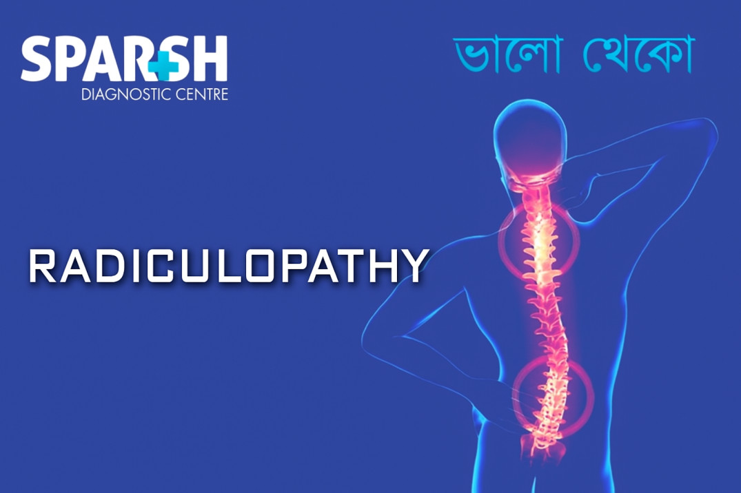 Radiculopathy