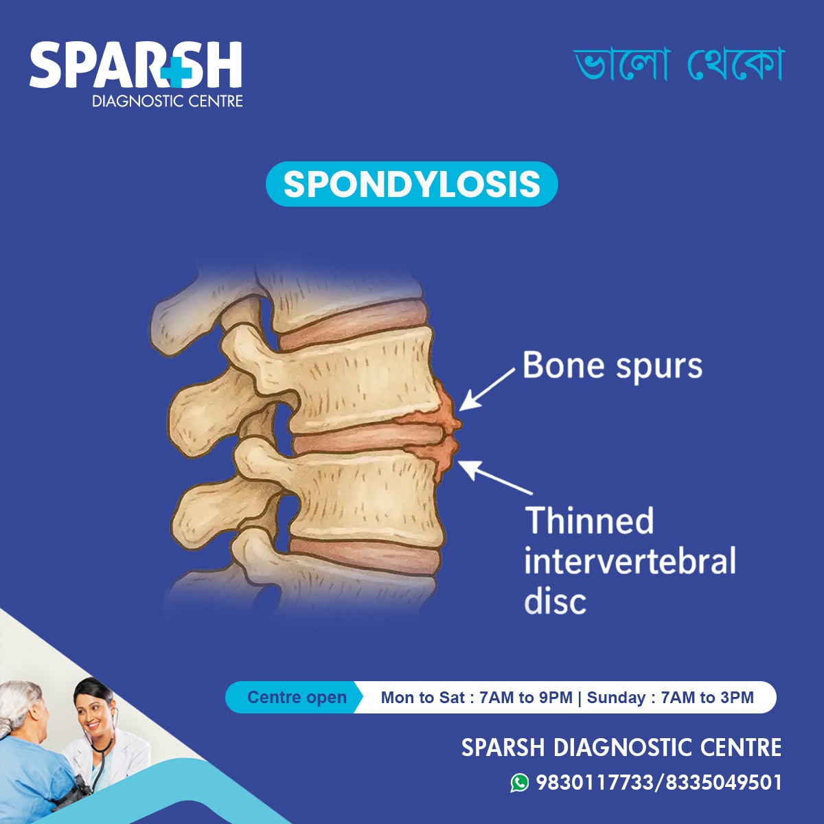 Spondylosis