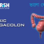 Toxic Megacolon