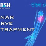 Ulnar Nerve Entrapment