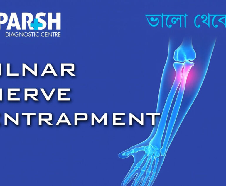 Ulnar Nerve Entrapment