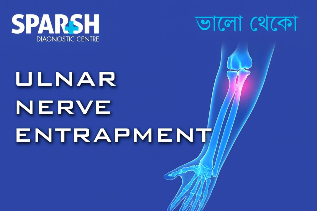Ulnar Nerve Entrapment