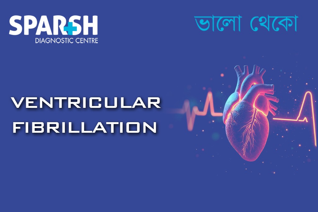Ventricular Fibrillation
