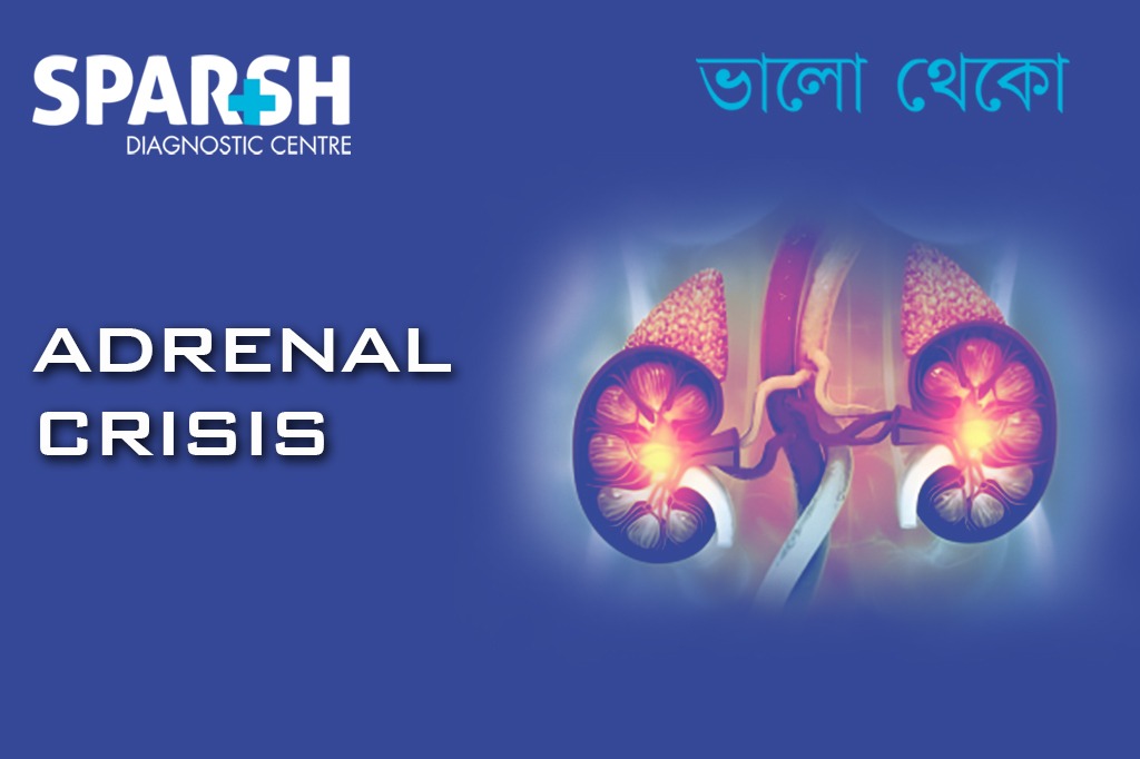 Adrenal Crisis