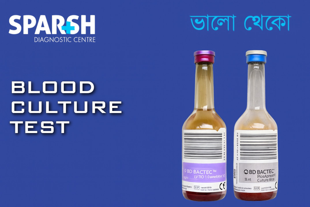Blood Culture Test