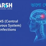 CNS Central Nervous System Infections