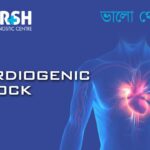 Cardiogenic Shock