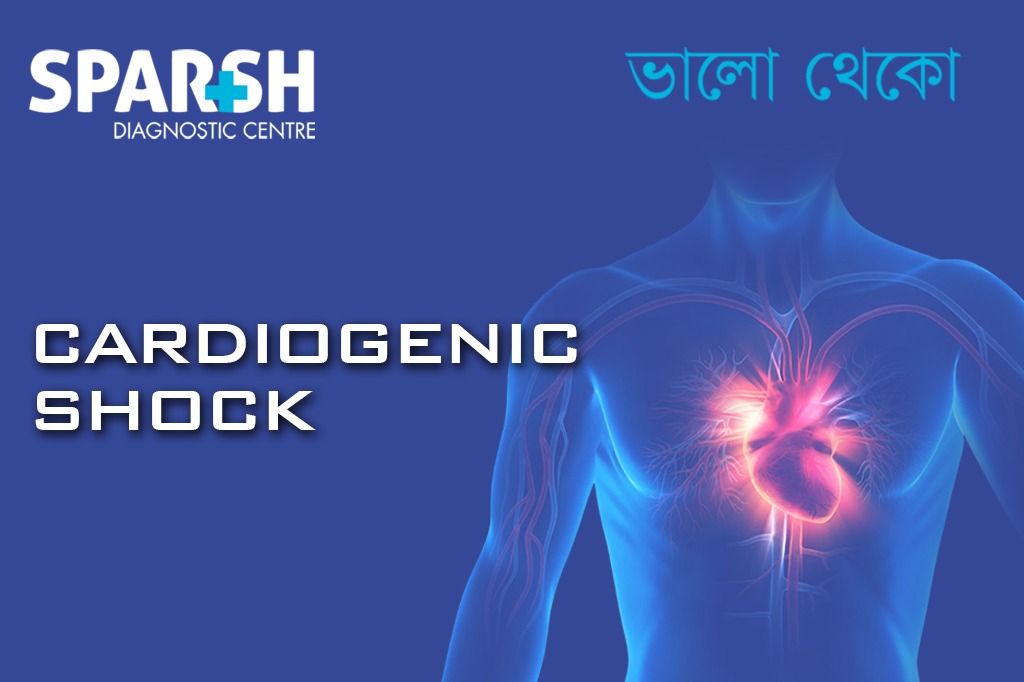 Cardiogenic Shock