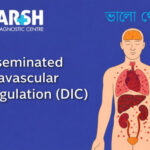 Disseminated Intravascular Coagulation DIC