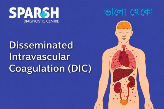Disseminated Intravascular Coagulation DIC
