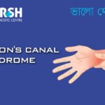 Guyons Canal Syndrome CP