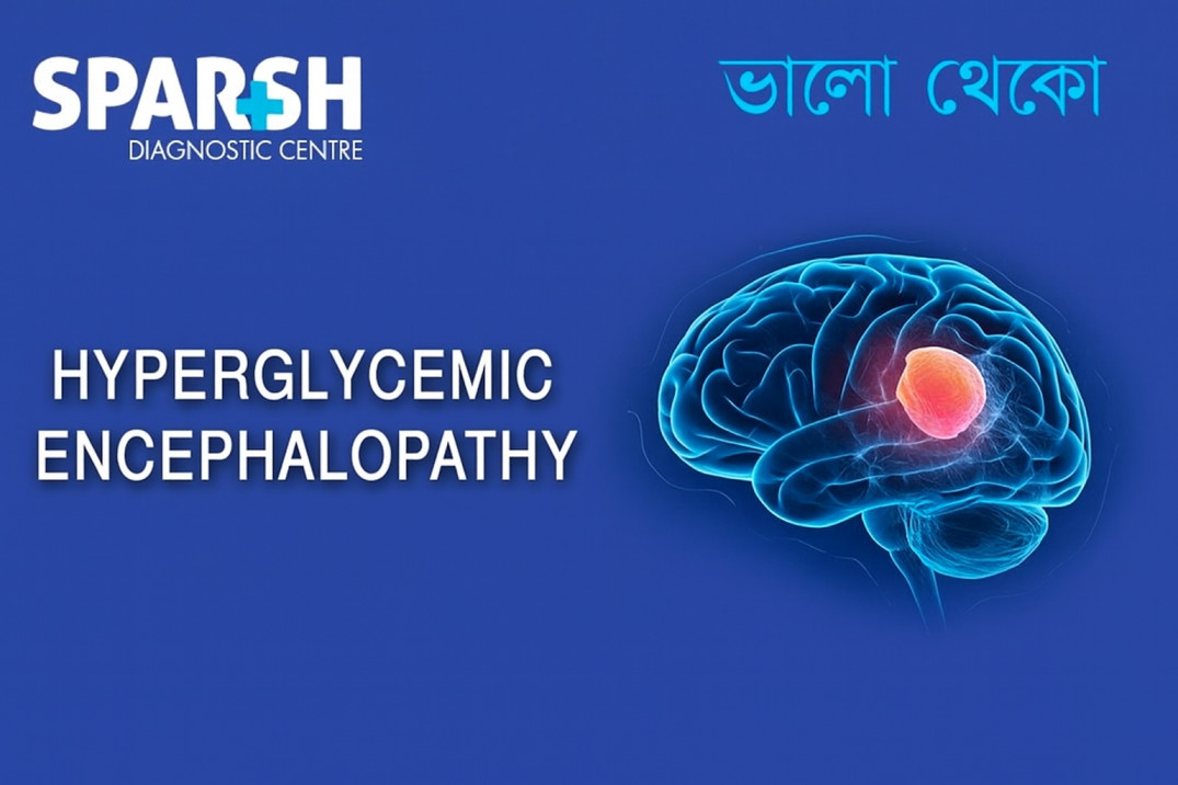 Hyperglycemic Encephalopathy